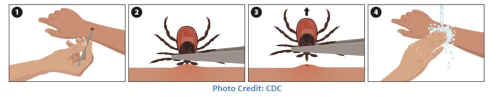 Tick removal graphic